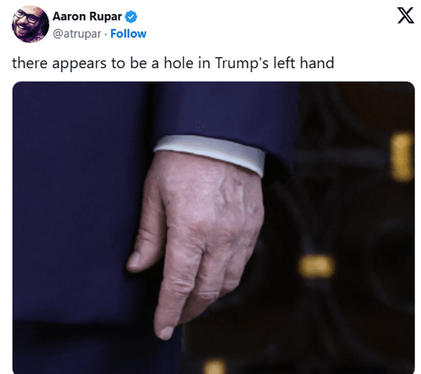 شایعات درباره وضعیت سلامتی ترامپ دوباره داغ شد | تصاویر دست چپ خبرساز شد شایعات درباره وضعیت سلامتی ترامپ دوباره داغ شد | تصاویر دست چپ خبرساز شد