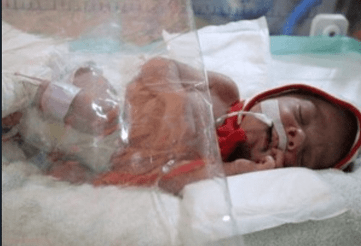 رئیس بخش سوختگی مرکز آموزشی درمانی شفا کرمان گفت: مادر بارداری که دچار سوختگی ۵۰ درصدی شده بود با تلاش پزشکان و پرستاران مرکز آموزشی درمانی شفا عمل جراحی اورژانسی سزارین شد و حال نوزاد تازه متولد شده و مادر مساعد است.