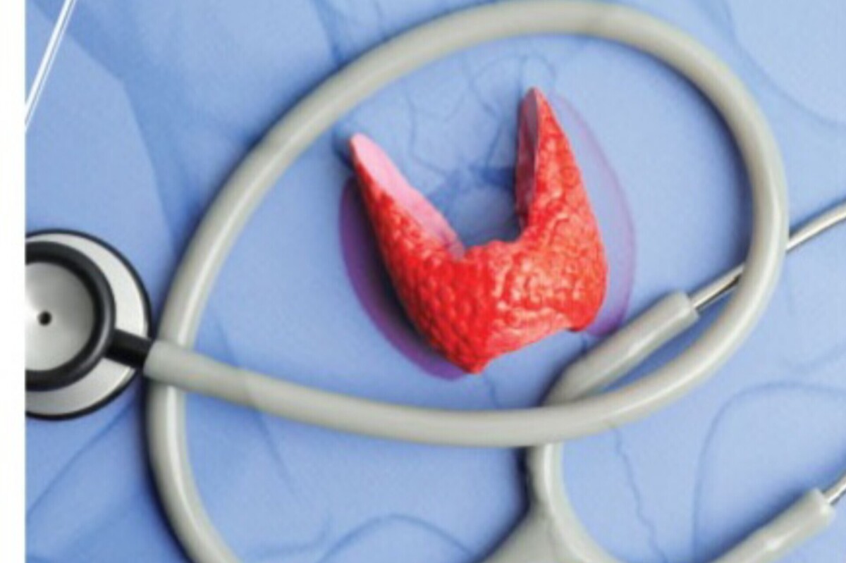 این غده خاص | درباره بیماری شایع در زنان که درمانی ساده دارد