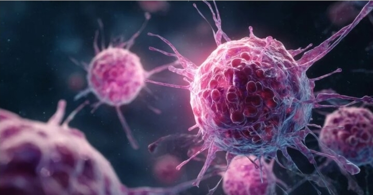 زنان کمتر از مردان به سرطان معده مبتلا می‌شوند