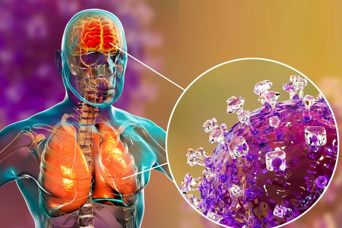 همه‌چیز درباره ویروس نیپا + علائم، راه‌های پیشگیری و مقایسه با کرونا