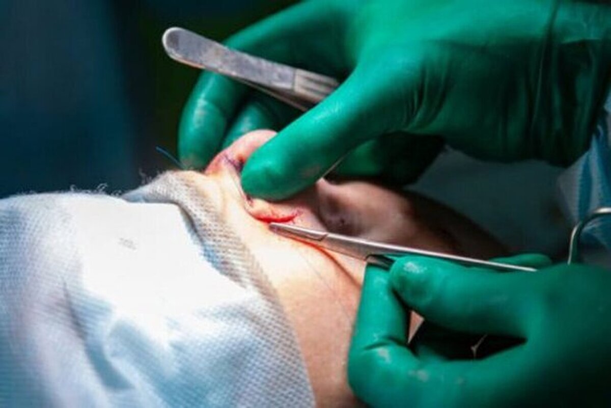 بازار ۴۲ میلیارد دلاری عمل‌های زیبایی در چین| صنعتی که زیر نظر دقیق دولت است