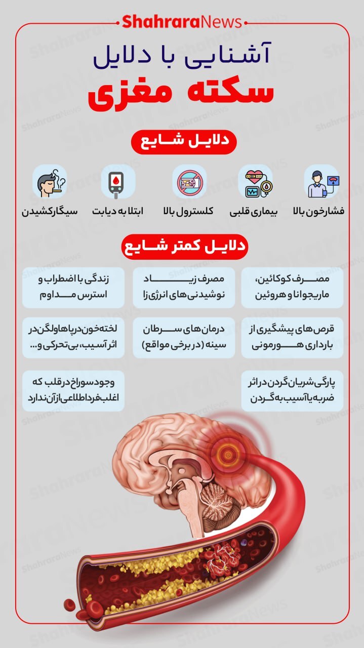 اینفوگرافی| آشنایی با دلایل سکته مغزی