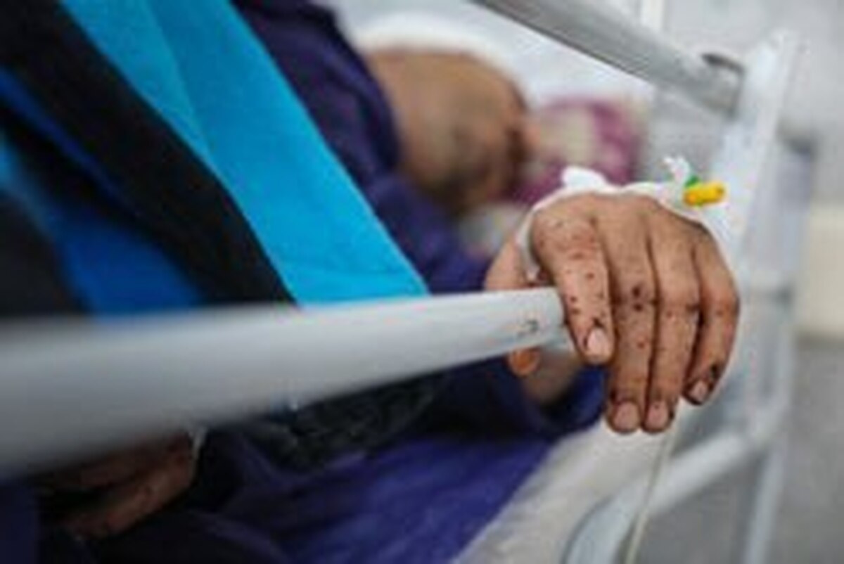 تعداد مصدومان انفجار در بندرعباس به ۱۴ نفر افزایش یافت (۱۱ بهمن ۱۴۰۴)