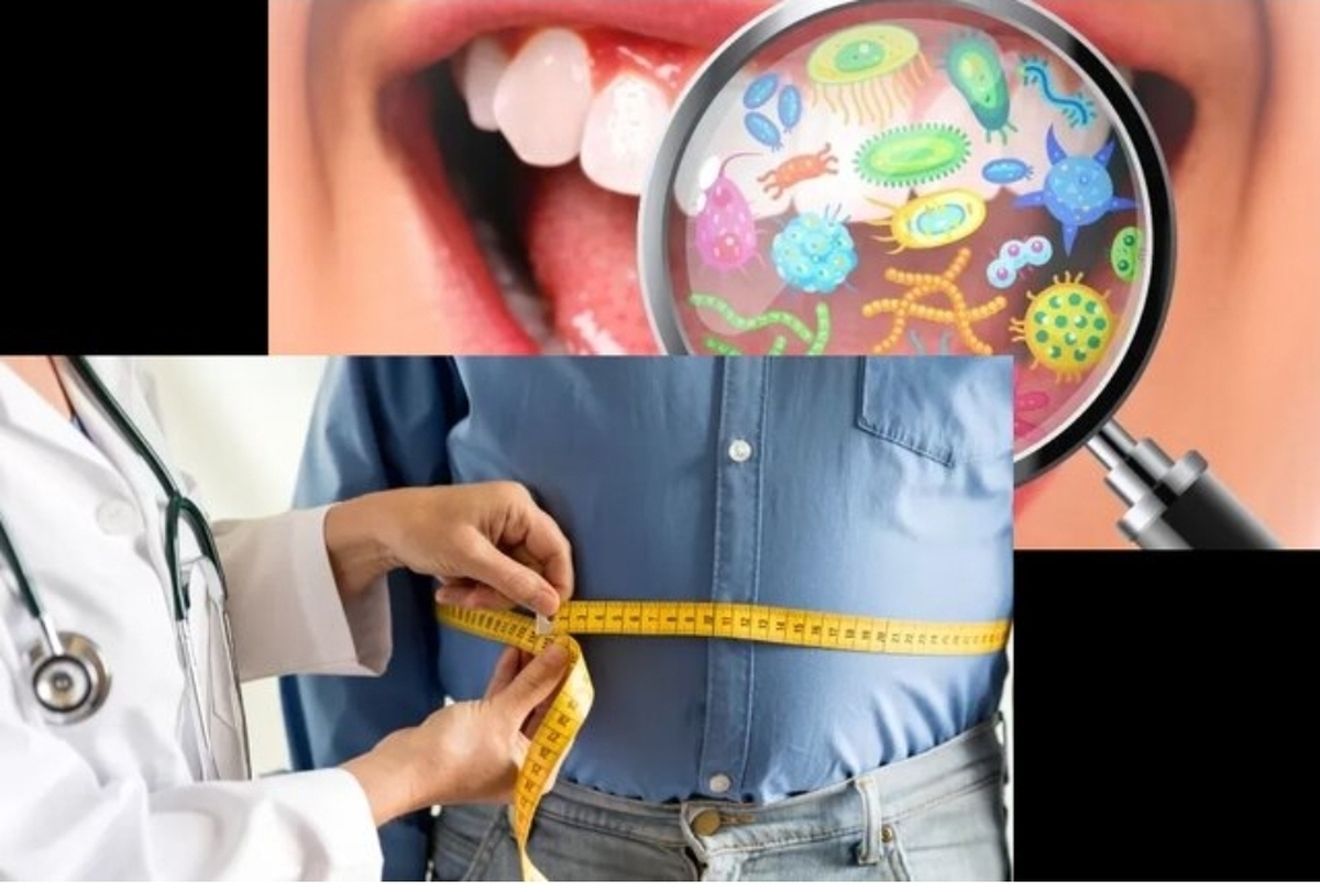 آیا میان میکروب‌های دهان و چاقی، ارتباطی وجود دارد؟