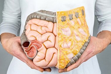 اینفوگرافی| چگونه سلامت گوارش را بهبود بخشیم؟