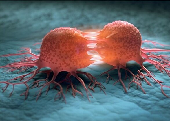 امکان پیشگیری از سرطان‌های پستان و دهانه رحم وجود دارد| تشریح اهمیت حیاتی غربالگری منظم