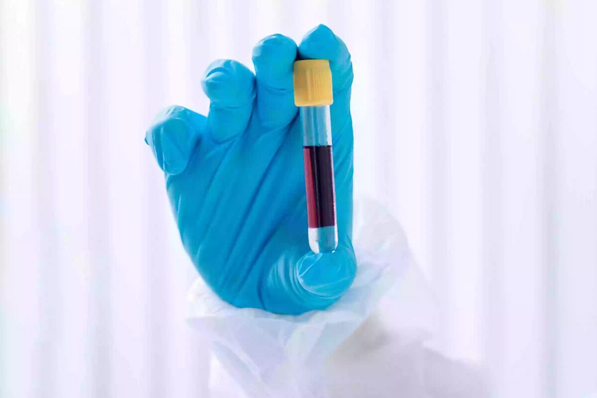 انجام کدام آزمایشات برای بانوان ضروری است؟