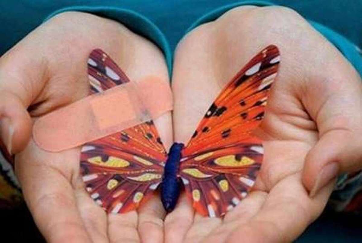 تداوم خدمات خانه&zwnj; &laquo;ای&zwnj;بی&raquo; به بیماران پروانه&zwnj;ای در سراسر کشور