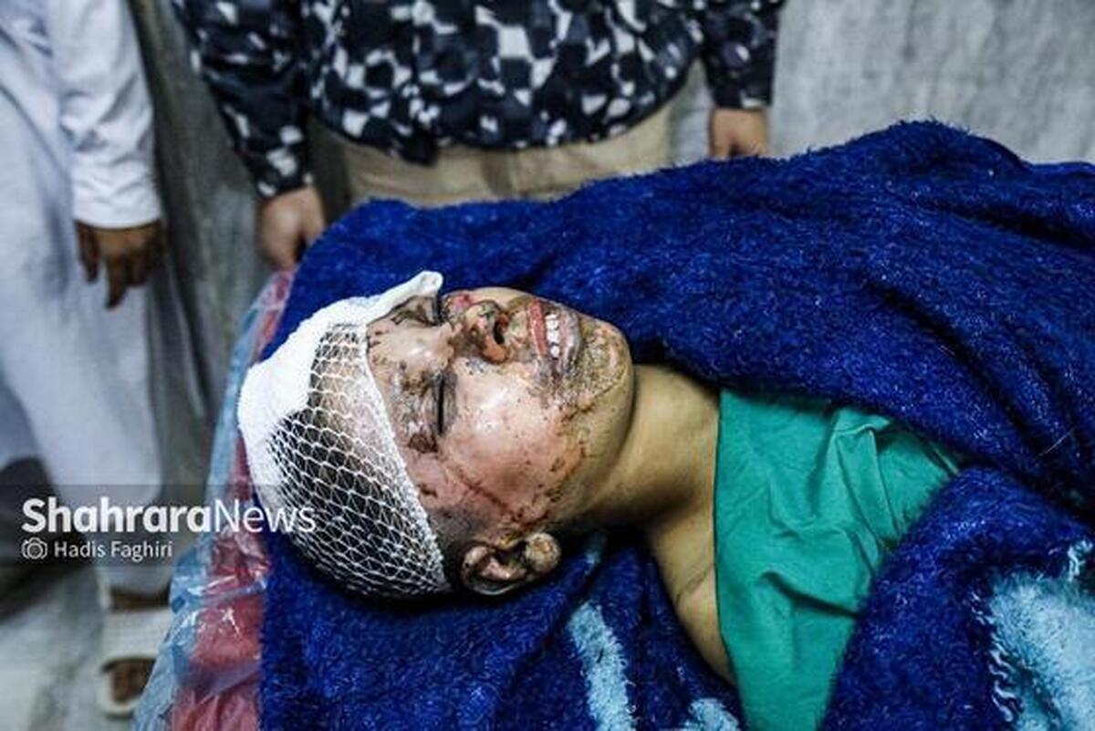 حوادث چهارشنبه‌سوری؛ ۳۳۱ مصدوم تاکنون| ۱۲ نفر قطع عضو شدند