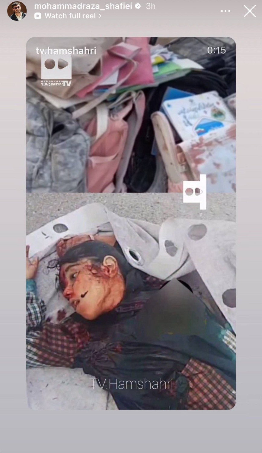 واکنش هنرمندان و چهره‌ها به حمله رژیم صهیونیستی به خاک کشورمان + تصاویر