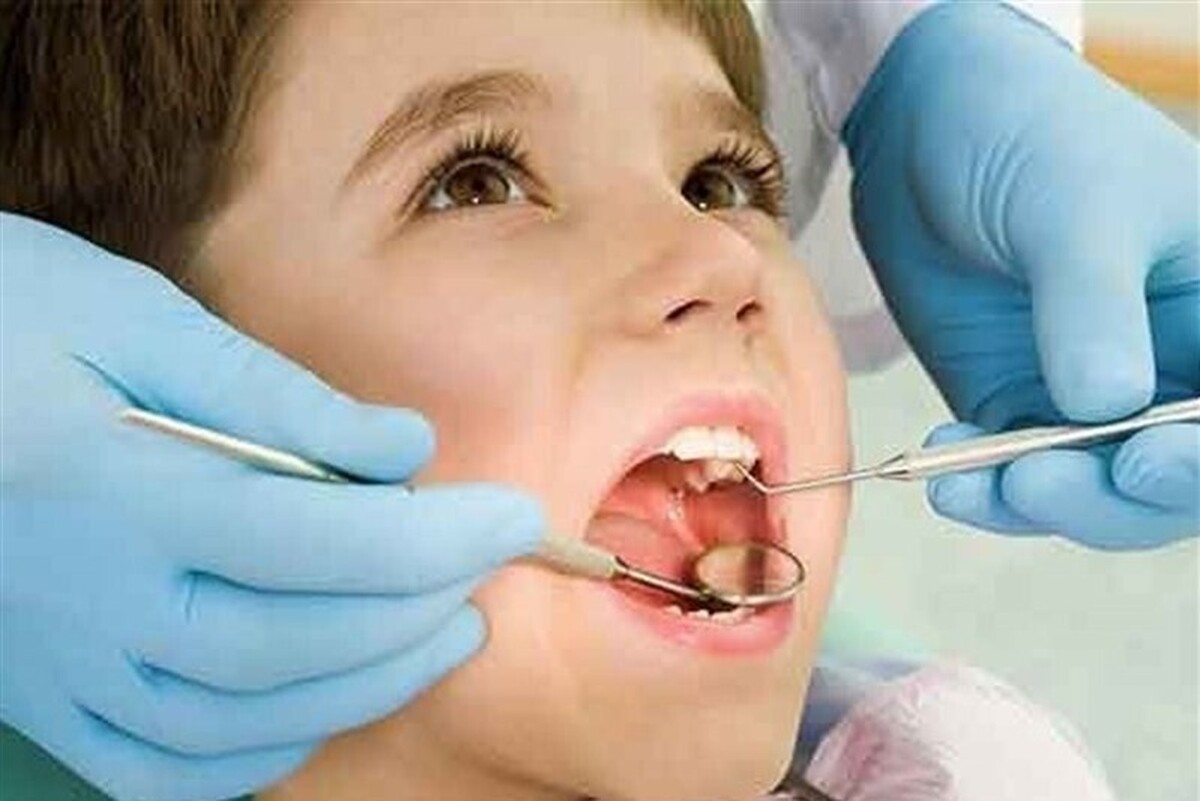 برای سیاه نشدن دندان کودک پس از مصرف قطره آهن چه کنیم؟
