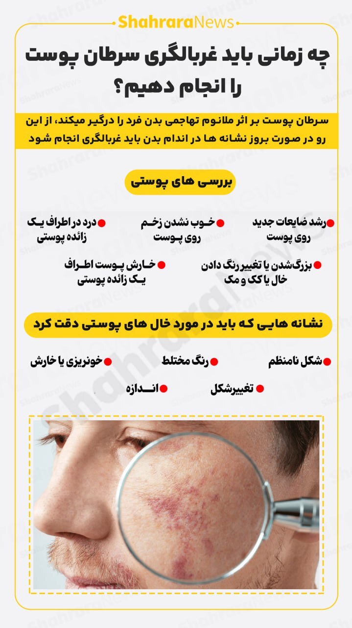 اینفوگرافی| چه زمانی باید غربالگری سرطان پوست را انجام دهیم؟