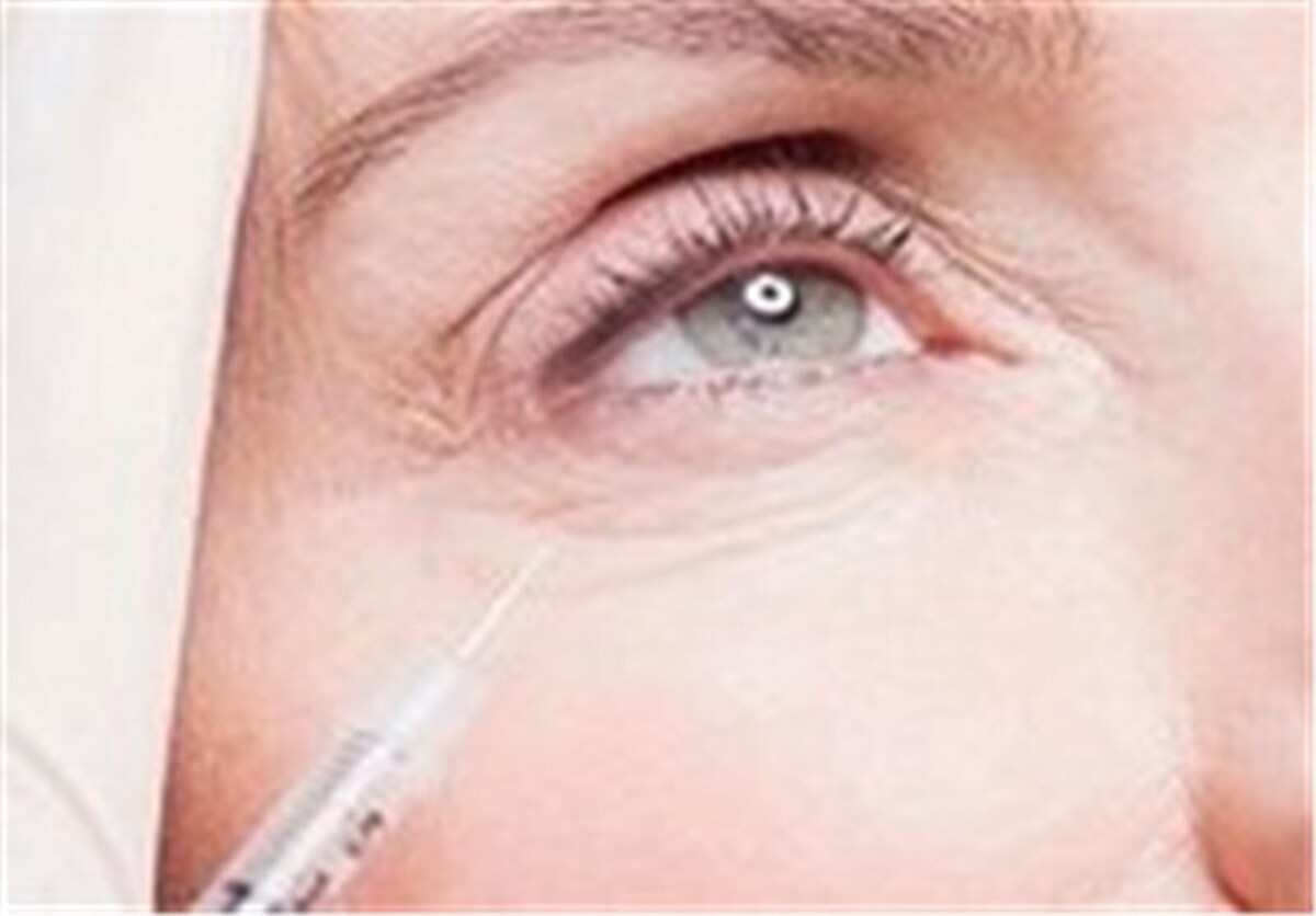 از تزریق ژل های بدون مجوز پرهیز کنید