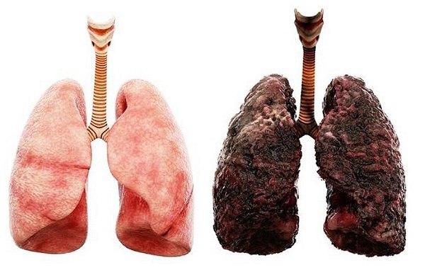 خراسان رضوی، رتبه چهارم ابتلا به بیماری‌های ریوی در کشور| روایت راهکار‌هایی که نفس‌هایمان را نجات می‌دهد