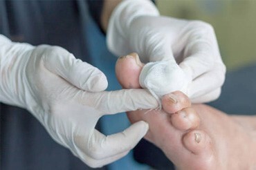 هشدار به دیابتی ها در مشهد؛ مراقبت روزانه از پا نکنید، خطر زخم در کمین شماست هشدار به دیابتی ها در مشهد؛ مراقبت روزانه از پا نکنید، خطر زخم در کمین شماست