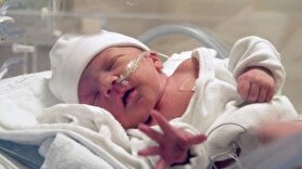 بررسی دلایل تولد نارس برخی نوزادان