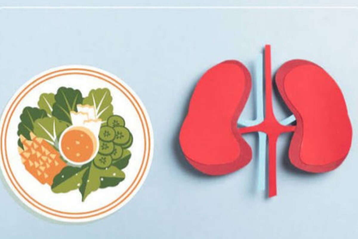 بررسی چند راه حل برای پیشگیری از سنگ کلیه