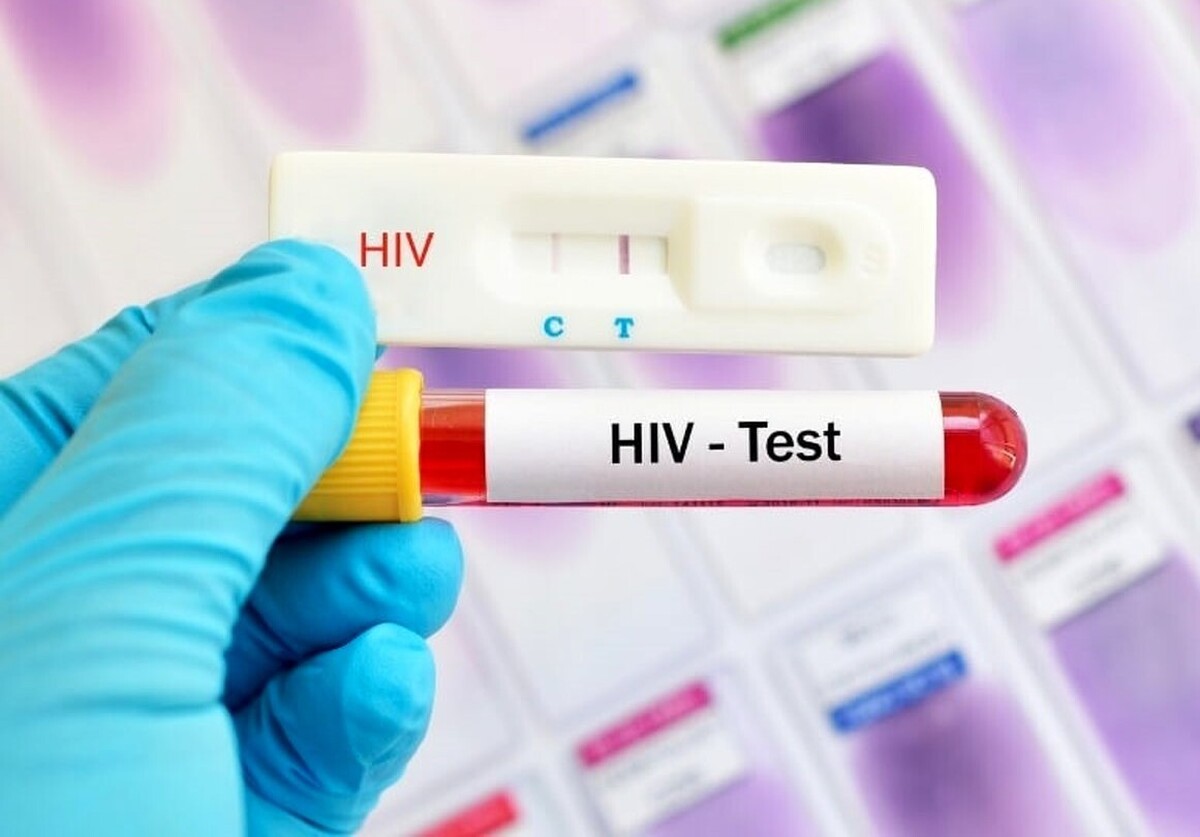 انجام تست رایگان و محرمانه HIV در مناطق تحت پوشش دانشگاه علوم پزشکی مشهد