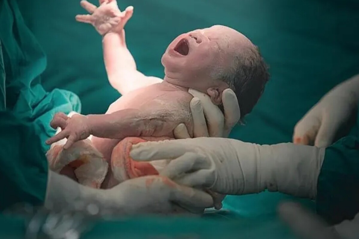 طبیعی یا سزارین | انتخاب مادرانه در میان تجربه‌ها و ترس‌ها