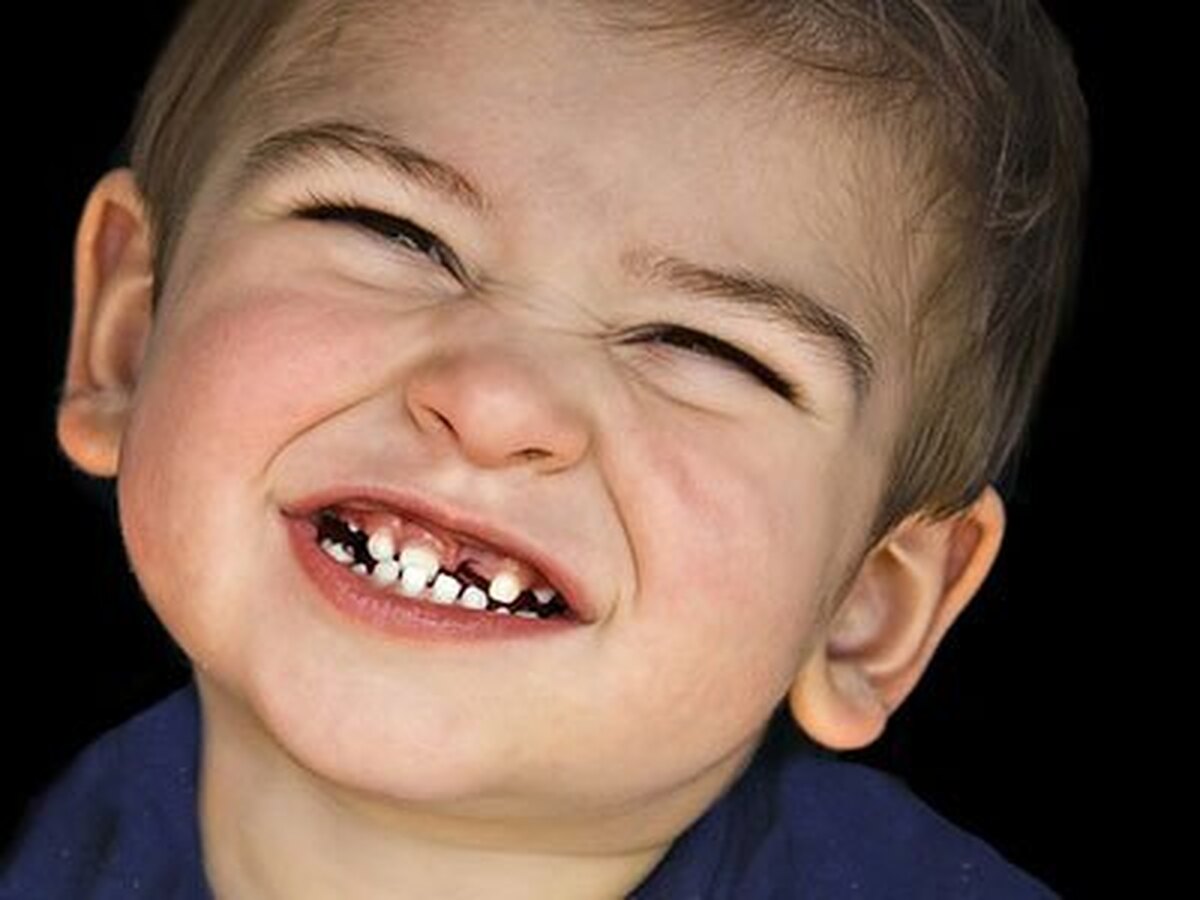 دندان قروچه را چگونه درمان کنیم؟