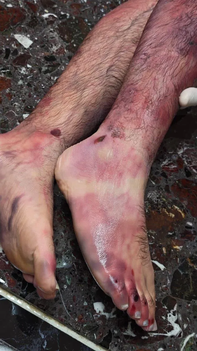 آل خلیفه، شهروند بحرینی حامی ایران را زیر شکنجه به شهادت رساند +تصاویر