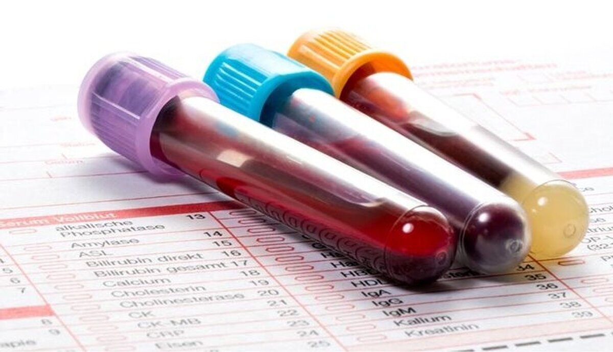 ۲۳ هزار بیمار تالاسمی در کشور زندگی می‌کنند