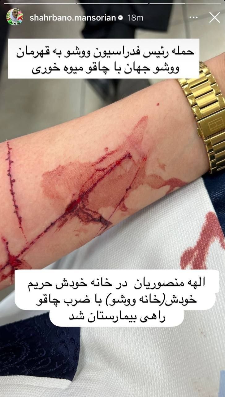 اتهام سنگین منصوریان علیه رئیس ووشو | فدراسیون: برای فضاسازی خودزنی کردند! + عکس اتهام سنگین منصوریان علیه رئیس ووشو | فدراسیون: برای فضاسازی خودزنی کردند! + عکس