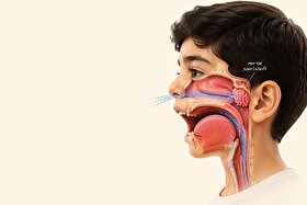لوزه‌ای با تهدیدات آتی | درباره التهاب لوزه سوم که عامل مشکلات متعدد در کودکان است