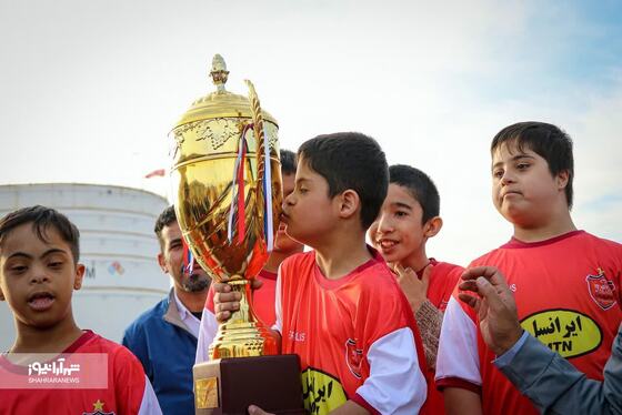 کودکان سندروم داون