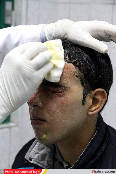 مصدومین آخرین چهارشنبه سال 