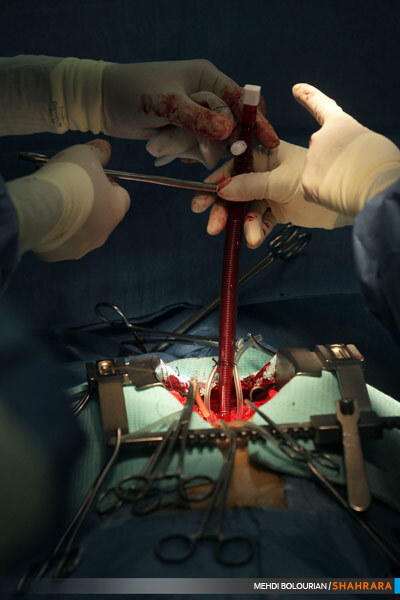 عمل جراحی قلب پنجمین کنگره بین المللی قلب و عروق