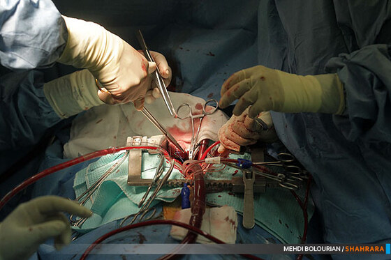 عمل جراحی قلب پنجمین کنگره بین المللی قلب و عروق