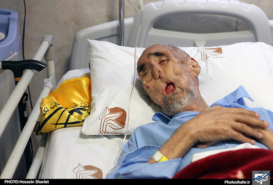 گزارش تصویری | عیادت شهردار مشهد از بابا رجب | عکاس :حسین شریعت /شهرآرا