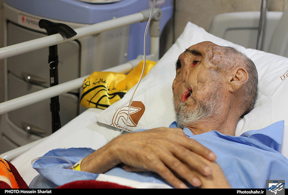 گزارش تصویری | عیادت شهردار مشهد از بابا رجب | عکاس :حسین شریعت /شهرآرا