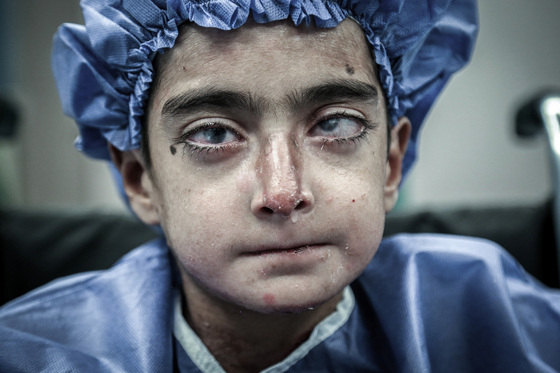 رنج پروانه ای 