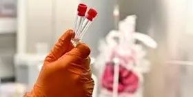 آغاز طرح تحقیقاتی &laquo;سلول درمانی&raquo;/ ۳۰ طرح درمان کرونا در دست بررسی