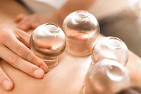 "حجامت" علت بیشترین مراجعه مردم به سلامتکده‌های طب سنتی