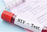 از وضعیت HIV در ایران چه می‌دانیم؟
