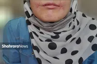 مرد معتاد لب‌های زن ۱۸ ساله‌اش را دوخت| اظهارات تکان‌دهنده فائزه در کلانتری خواجه‌ربیع مشهد