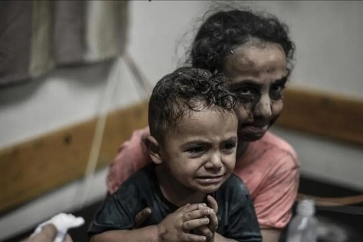 سازمان ملل: بیش از ۹هزار کودک زیر ۵ سال در غزه از سوءتغذیه رنج می‌برند
