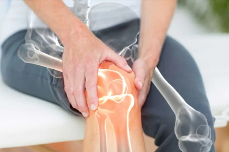 درباره پوکی استخوان و راه های پیشگیری این بیماری