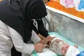 خطر طغیان سرخک در خراسان رضوی زیر سایه واکسن هراسی