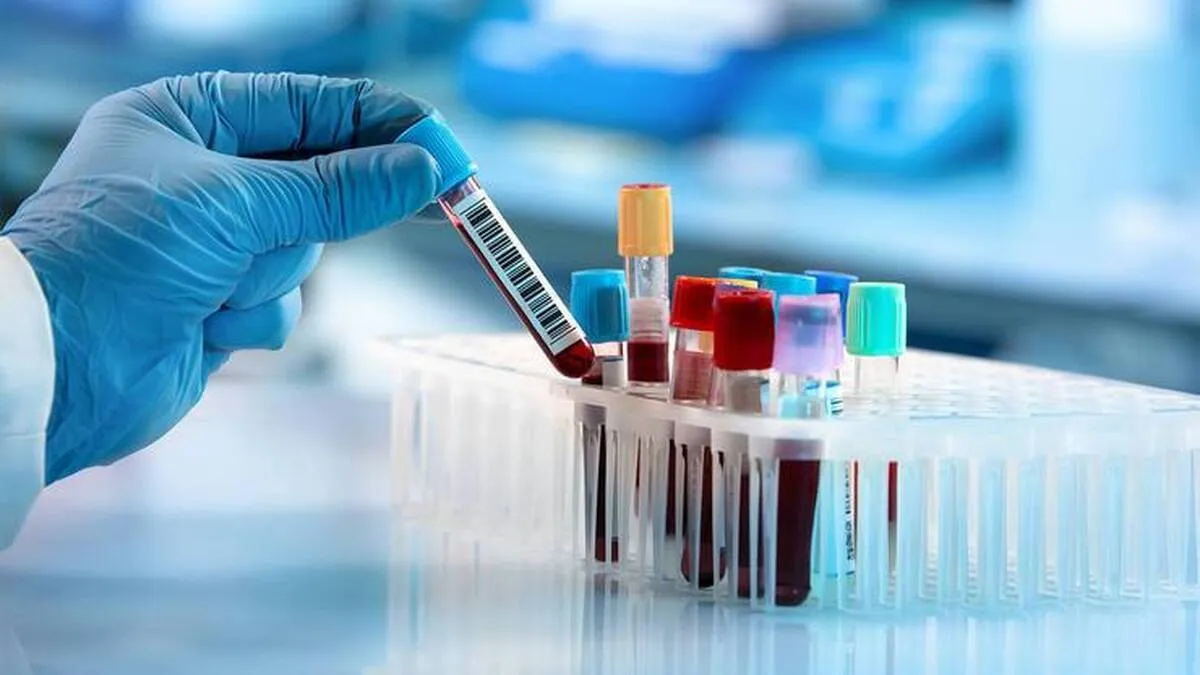 خدمات تشخیصی آزمایشگاهی تب دنگی در شبکه‌های آزمایشگاهی چند استان ارائه می‌شود