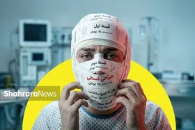 زیبایی قسطی | پرداخت قسط جراحی بینی به جای تأمین مایحتاج ضروری!