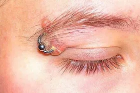 حلقه&zwnj;های مرگ&zwnj;بار زیبایی، خطر ابتلا به بیماری&zwnj;های عفونی و هپاتیت را به همراه دارد