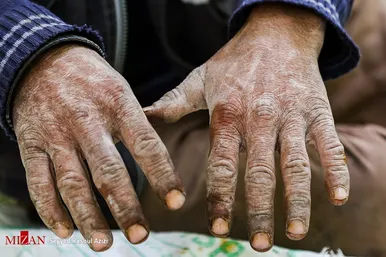 برداشت گردو در اطراف شهر درگز