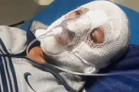 ویدیو | پلیسی که اغتشاشگران سر و صورتش را به آتش کشیدند (۱۱ دی ۱۴۰۴)