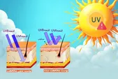 شاخص UV چیست و چرا باید روزانه آن را رصد کنیم؟ | سوختگی ارغوانی