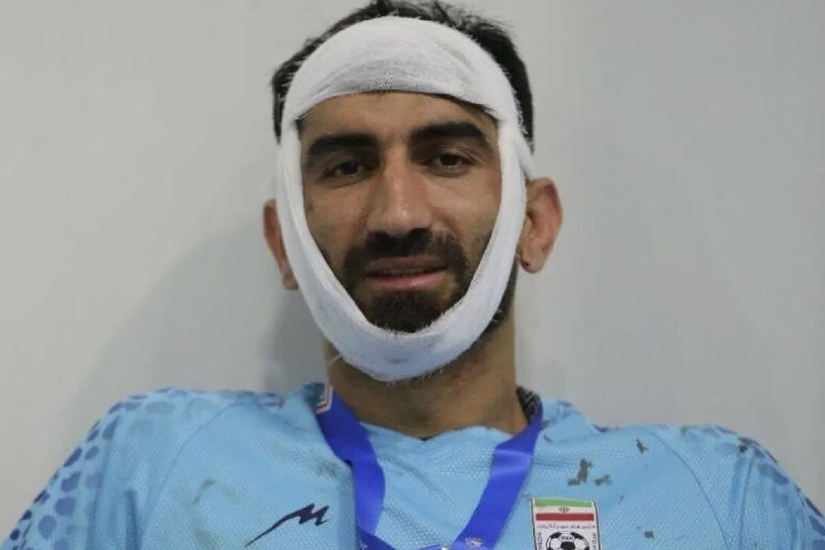 علیرضا بیرانوند زیر تیغ جراحی رفت